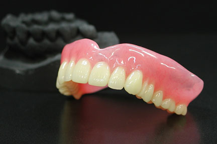 入れ歯・インプラント