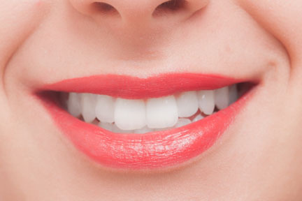 ホワイトニング